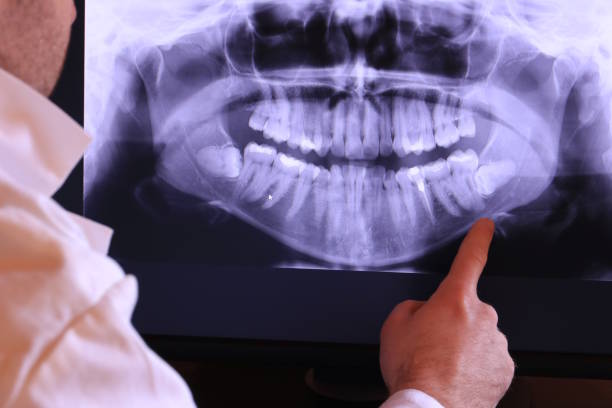 Best Emergency Dental Care for Broken or Chipped Teeth in Shawneetown, IL